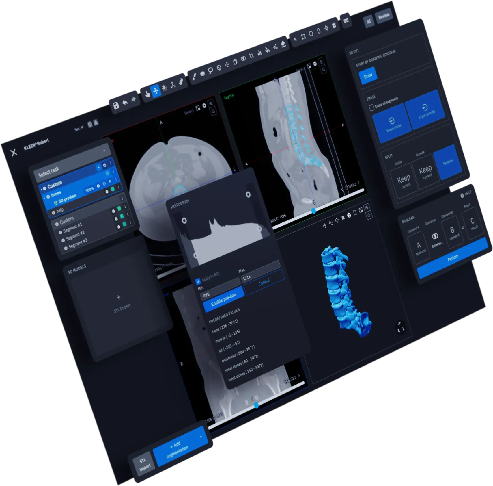 Designed with intuitive functionality for radiology labeling