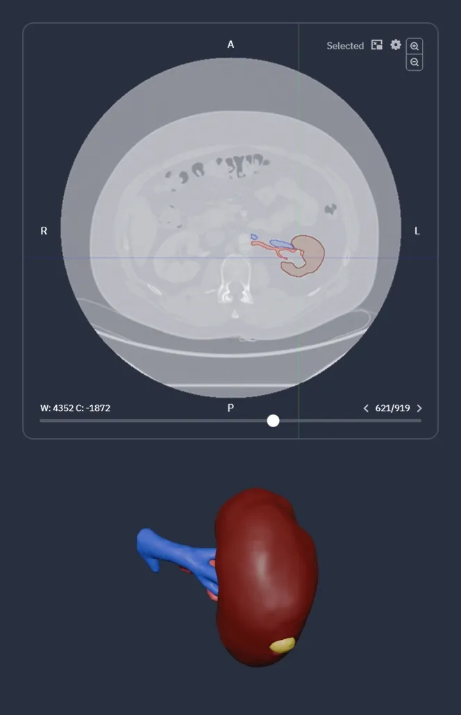 3D surgical planning